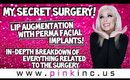 My Lip Augmentation With Perma Facial Implants! In-Depth Breakdown of Everything! | Tanya Feifel
