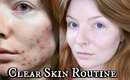 Anti-Acne Skincare Routine | How I Cleared My Skin | Talk Through