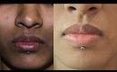How To Remove Dark Spots, Black Patches, Hyper pigmentation _ Around Mouth | SuperWowStyle Prachi