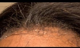 Quick talk ! Lace help!!! Help!