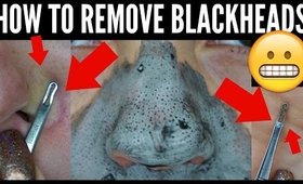 How To REMOVE BLACKHEADS | SKINCARE ROUTINE