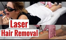 Laser Hair Removal: My Review 2017