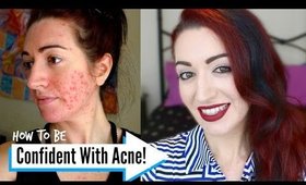 HOW TO: Be POSITIVE & CONFIDENT With Acne! Build Confidence!