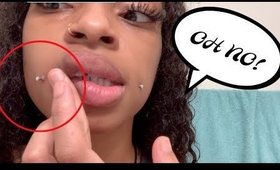 F%$K!! , I'm Getting A KELOID on ONE Cheek Piercing !! ft.Juila hair