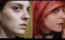 Acne Coverage Foundation Routine / Rutina de Maquillaje Para Cubrir Acne