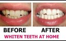 WHITEN TEETH AT HOME FAST