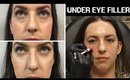 All About Under Eye Filler 💉 Restylane & Restylane Lyft, Before & After Photos, Does It Work, Cost