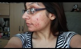 Is acne permanent? How can I get clear skin?