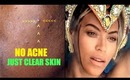 NO ACNE ONLY CLEAR SKIN LIKE BEYONCE IN "BLUE " #SKINCARESUNDAY