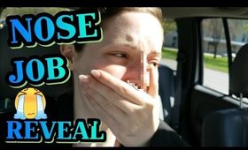 Emotional Rhinoplasty Nose Job Reveal! | Caitlyn Kreklewich