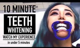 10 Minute Teeth Whitening ♥ Quickest Whitening at Dentist Cost & Review  ♥ Philips Zoom Quickpro