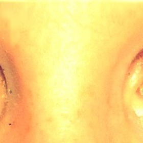 Eyes(: