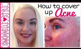 How to Cover Up Acne {Full Coverage Acne Foundation Routine} SimDanelleStyle