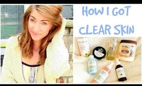 What Saved My Skin | Skincare Favorites