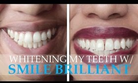 Whitening My Teeth w/ Smile Brilliant