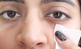 डार्क सर्किल  _ How to: Remove Dark Circles in 3 Ways? _ Dark Circle Home Remedy | SuperWowStyle