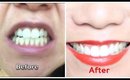 Teeth Whitening At Home - Does it work? (Dazzlepro 7 Day Smilepacks are not Crest Strips!)