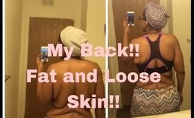 Loose Skin and Fat |My Back