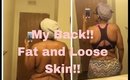 Loose Skin and Fat |My Back