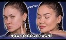 HOW TO COVER ACNE - FOUNDATION ROUTINE | Maryam Maquillage