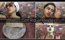 5 Good Habits of People Who got Rid of Acne | SuperWowStyle Prachi