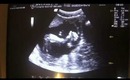 19weekPreggos VLOG+Baby Gender&Name!!!