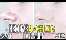 How To Get Rid Of Blackheads & Whiteheads OVERNIGHT !