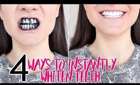 How To INSTANTLY WHITEN YOUR TEETH !!