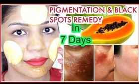 Skin Whitening Black Spots & Skin Pigmentation Treatment Natural Remedy | SuperPrincessjo