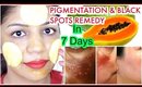 Skin Whitening Black Spots & Skin Pigmentation Treatment Natural Remedy | SuperPrincessjo