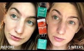 HUM NUTRITION HONEST REVIEW + GIVEAWAY