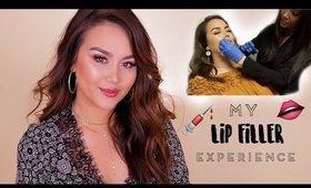 MY LIP FILLER EXPERIENCE | JUVEDERM