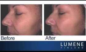 Dramatic Anti-Aging Results With Lumene