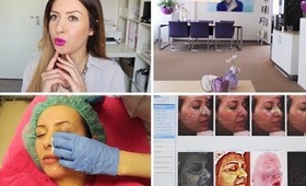 Mijn ervaring (Acne) Peeling & IPL behandeling bij Velthuis Kliniek
