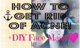 How to Get Rid of Acne + DIY Face Mask! || Alexthepotato1