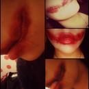 Cut Lips/Mouth