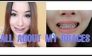 Vlog: All about my Braces - 7 months update- Overbite picture before and after