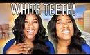 HOW I GET MY TEETH WHITE! (THE BEST HOME TEETH WHITENING KIT)
