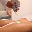 The Basis of Laser Hair Removal and Its Use