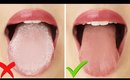 HOW TO: Get Rid of White Tongue & Bad Breath INSTANTLY!