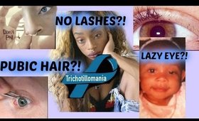 I Pull My Eyelashes OUT Hair, Pubic Hair,(Trichotillomania Disorder) Storytime