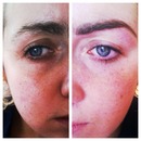 Before and after brows 
