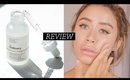 THE ORDINARY NIACINAMIDE 10% ZINC 1% REVIEW | On sensitive combo dry acne prone skin