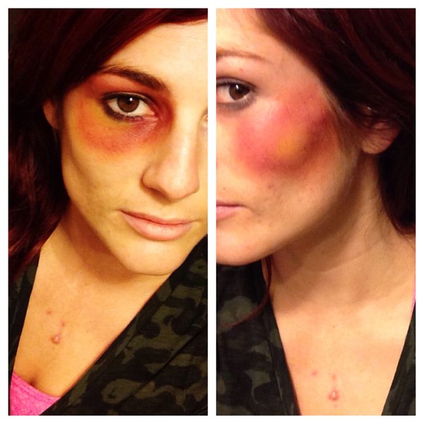 Special effects bruise Brittany P.'s Photo Beautylish