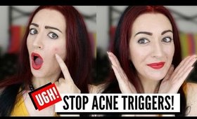 How To Keep Your Skin ACNE FREE This Christmas! Stop Pimples, Acne & Blackheads!