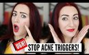 How To Keep Your Skin ACNE FREE This Christmas! Stop Pimples, Acne & Blackheads!