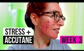 I HATE BEING STRESSED! | WEEK THREE OF ACCUTANE | Jess Bunty Acne Vlog 3
