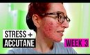 I HATE BEING STRESSED! | WEEK THREE OF ACCUTANE | Jess Bunty Acne Vlog 3
