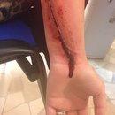 Ouch!