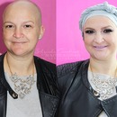 Mommy ♥ Before/After - Beautiful in chemotherapy